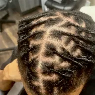 Top-down view of a freeform loc pattern