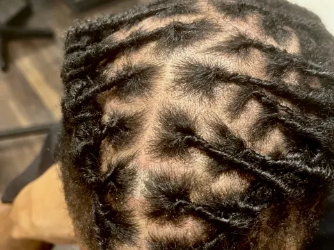 Top-down view of a freeform loc pattern